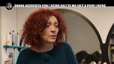 BONISTALLI: Donna aggredita con l'acido dall'ex ma lui è a piede libero