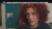 BONISTALLI: Donna aggredita con l'acido dall'ex ma lui è a piede libero