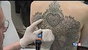 Addio tatuaggio non ti voglio più!