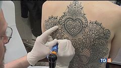 Addio tatuaggio non ti voglio più!