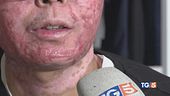 "La mia vita rovinata in quei trenta secondi"