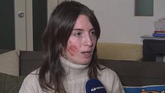 "Quel rogo mi ha cambiato la vita"