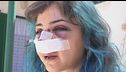 26enne picchiata a Bari: "Venivo pestata, la gente guardava"