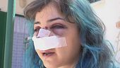 26enne picchiata a Bari: "Venivo pestata, la gente guardava"