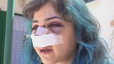 26enne picchiata a Bari: "Venivo pestata, la gente guardava"