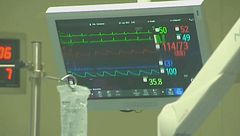 Cuore danneggiato impiantato su un bambino, aperte tre inchieste