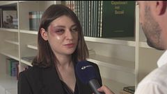 Milano , modella aggredita e picchiata dal "branco" in pieno giorno