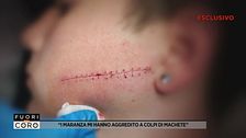 "I maranza mi hanno aggredito a colpi di machete"
