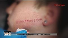 "I maranza mi hanno aggredito a colpi di machete"