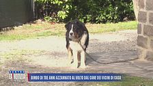 Bimbo di tre anni azzannato al volto dal cane dei vicini di casa