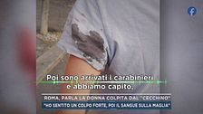 Roma, parla la donna colpita dal "cecchino"