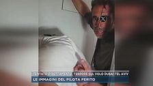 Tentato dirottamento, le immagini del pilota ferito