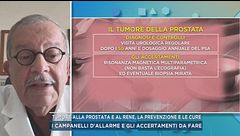 Tumore alla prostata e al rene, la prevenzione e le cure