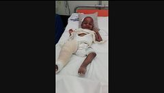 Disabili in Kenya, le gambe di Victor sono tornate diritte