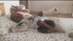 La fisioterapia di Victor, il bambino di cristallo