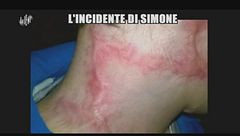 ROMA: La storia del bambino mascherato