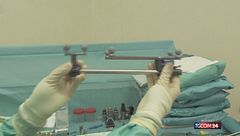 Fondazione Policlinico Campus Biomedico, nuovo centro per le patologie ortopediche e spinali