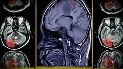 ep.18 - La sindrome di Havana